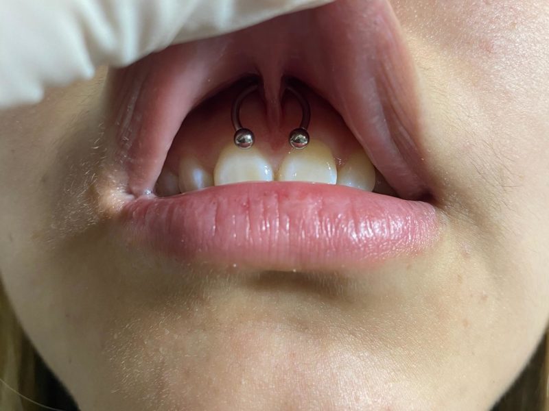 Piercing 100